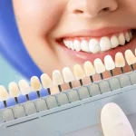 smiling young woman cosmetological teeth whitenin crc7d91ec2e size6.53mb 4872x3248 - title:Home - اورچین فایل - format: - sku: - keywords:وکتور,موکاپ,افکت متنی,پروژه افترافکت p_id:63922
