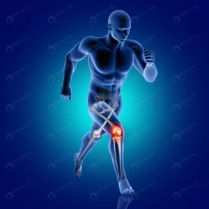 3d male medical figure running with knee bone hig crca208b44b size5.32mb 6000x6000 - title:Home - اورچین فایل - format: - sku: - keywords: p_id:18