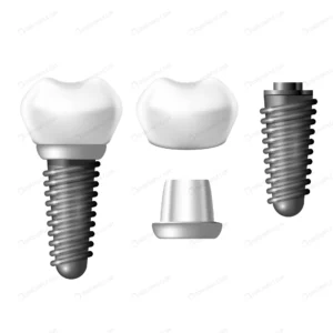 component parts dental implant teeth denture crcaa45ad77 size2.85mb - title:Home - اورچین فایل - format: - sku: - keywords: p_id:18