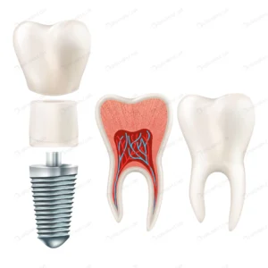 dental implant set crc0c12bd4b size2.91mb - title:Home - اورچین فایل - format: - sku: - keywords: p_id:18