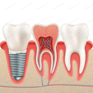 dental implant set crcf8e807c7 size6.76mb - title:Home - اورچین فایل - format: - sku: - keywords: p_id:18