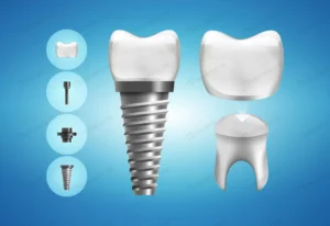 dental implant structure crown restoration realis crc1c78ba67 size4.84mb - title:Home - اورچین فایل - format: - sku: - keywords: p_id:18