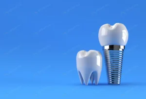 dental implants surgery concept 3d rendering crc9292d936 size1.72mb 4500x3060 - title:Home - اورچین فایل - format: - sku: - keywords: p_id:18