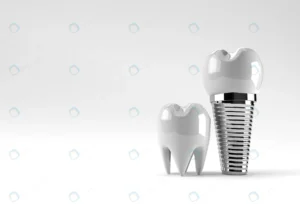 dental implants surgery concept 3d rendering crce13d2507 size1.58mb 4500x3060 - title:Home - اورچین فایل - format: - sku: - keywords: p_id:18