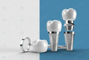 dental implants surgery concept transparent psd f crc66c60a22 size61.91mb - title:Home - اورچین فایل - format: - sku: - keywords: p_id:18