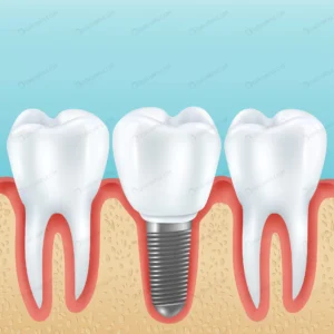 dental prosthetics with healthy teeth crcd554910e size3.88mb - title:Home - اورچین فایل - format: - sku: - keywords: p_id:18