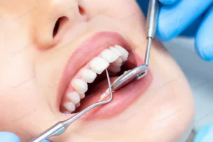 female dentist teeth examination crc49fc2696 size3.12mb 3001x2001 - title:Home - اورچین فایل - format: - sku: - keywords: p_id:18