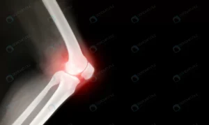 knee bone computer xray images crcd7c23c08 size2.65mb 6000x3584 - title:Home - اورچین فایل - format: - sku: - keywords: p_id:18