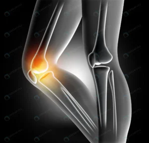 pain knee joint crca5cd67c5 size5.68mb 5904x5680 - title:Home Main - اورچین فایل - format: - sku: - keywords: p_id:18