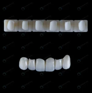 six upper jaw frontal ceramic crowns prosthesis b crc5c11beda size2.00mb 4435x4500 - title:Home - اورچین فایل - format: - sku: - keywords: p_id:18