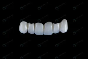 six upper jaw frontal ceramic crowns prosthesis b crc8d1be1ee size0.76mb 4500x3000 - title:Home - اورچین فایل - format: - sku: - keywords: p_id:18