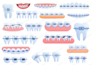 tooth braces icons set cartoon set tooth braces i crc5737683a size4.72mb - title:Home - اورچین فایل - format: - sku: - keywords: p_id:18