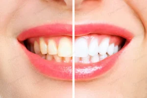 woman teeth before after whitening image symboliz crc3eb3574f size4.16mb 3057x2038 - title:Home - اورچین فایل - format: - sku: - keywords: p_id:18